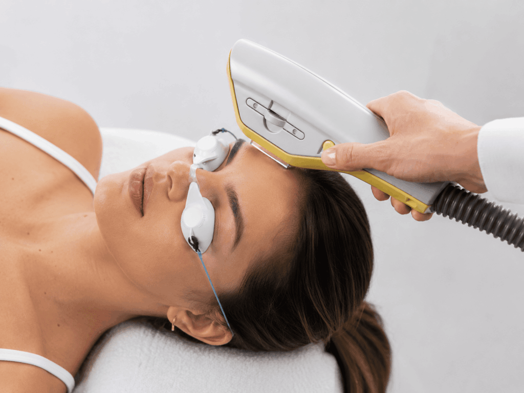 Foto do tratamento ipl-facial